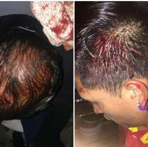 Severa golpiza le propinan ebrios Militares a empleados de un bar