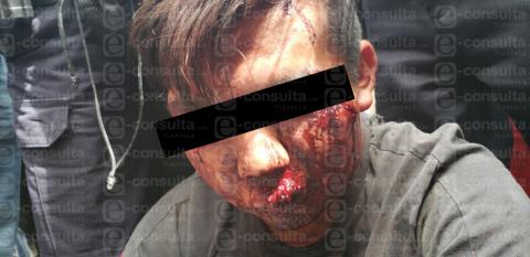 Delincuente atrapado y golpeado por pobladores de SPM murió