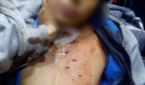 Dejan malherido a chofer de colectiva; imparables los atracos imagen 1