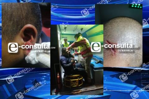 Agrede grupo de inconformes a elementos de seguridad durante operativo en Totolac