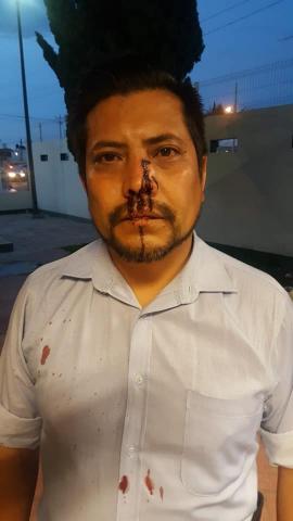 Malandrines tunden a golpes a periodista en Tzompantepec imagen 2