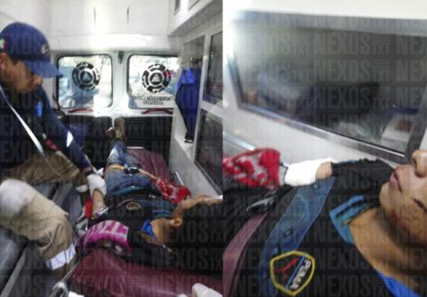 Cae hondureño del tren, y éste le amputa el brazo en Apizaco