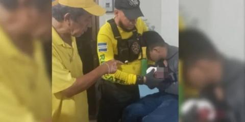 Por jugarle a la pirotecnia en El Salvador, un joven termina sin mano