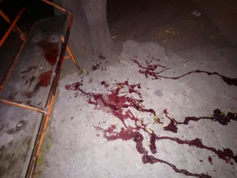Rastros de sangre alertan a pobladores en Apizaco imagen 1