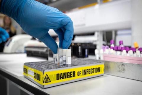 Científicos realizan fármaco anti-piojos que reduce el coronavirus en 48 horas