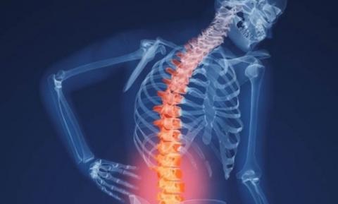 IMSS Tlaxcala emite recomendaciones para evitar lesiones de columna