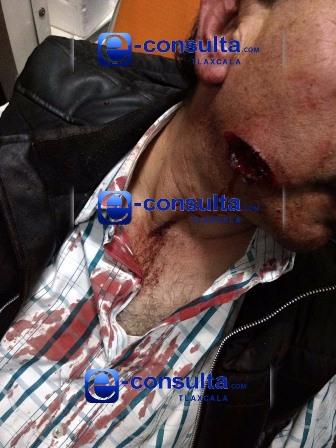 Hombres armados disparan y lesionan a una persona en calles de Apizaco imagen 1