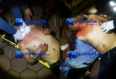 Apuñalan en el cuello a un hombre borracho en Tepeyanco