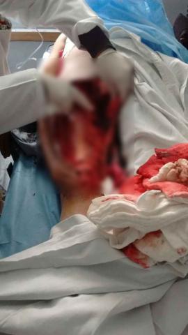 Mujer es atropellada por su propio repartidor de leche en Nativitas imagen 3