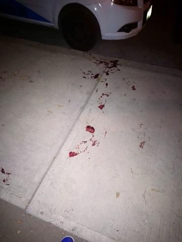 Rastros de sangre alertan a pobladores en Apizaco imagen 2