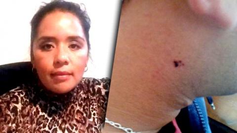 Lady influyente de la SESA golpea a expareja imagen 1