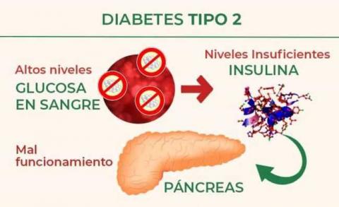 Emite IMSS Tlaxcala recomendaciones para no desarrollar prediabetes y diabetes
