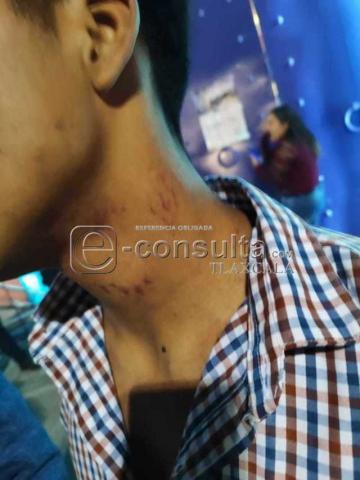 Además de agr3.%sivos, ladrones resultaron los guaruras del Palenque de la Feria imagen 3