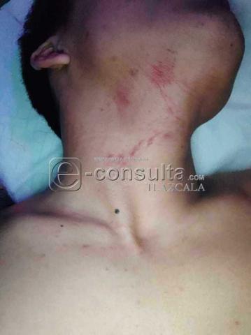 Además de agr3.%sivos, ladrones resultaron los guaruras del Palenque de la Feria imagen 7