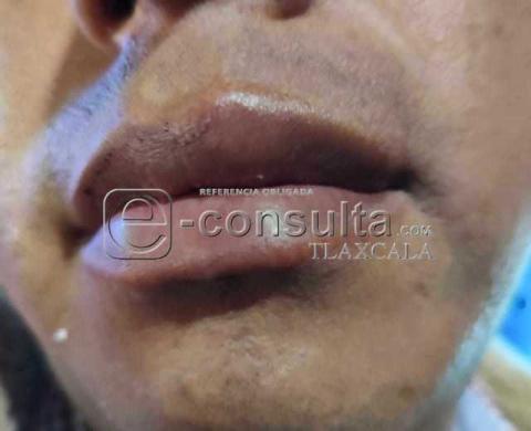 Además de agr3.%sivos, ladrones resultaron los guaruras del Palenque de la Feria imagen 8