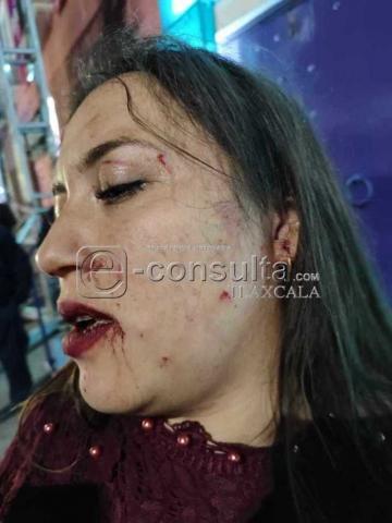Además de agr3.%sivos, ladrones resultaron los guaruras del Palenque de la Feria imagen 4
