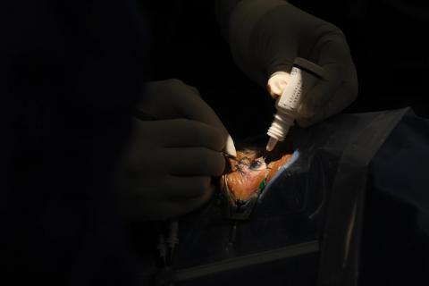 Inicia campaña de cirugías de cataratas y de mínima invasión imagen 7