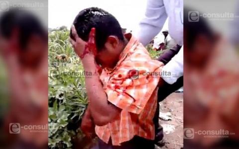 Bala de goma perforó cabeza de niño poblano en Chalchihuapan