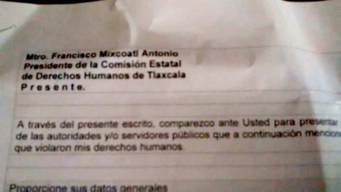 Derechos Humanos comparsa en negligencias de la SESA imagen 1