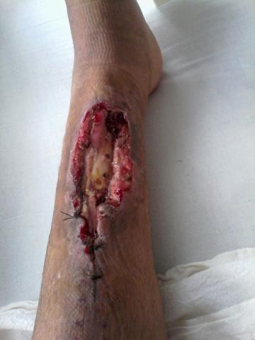 Derechos Humanos comparsa en negligencias de la SESA imagen 2